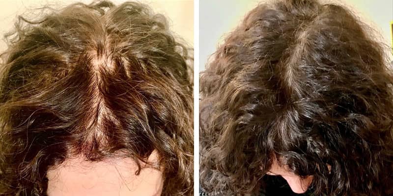 Before and after women’s hair loss