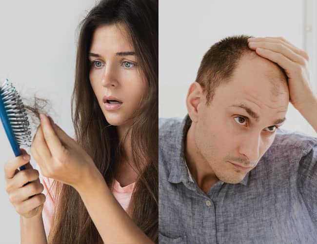 Man and woman dealing with hair loss
